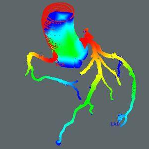 Connected Component and Morphology Based Extraction of Arterial Centerlines of the Heart (CocomoBeach)