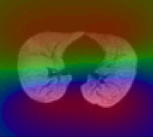 N4ITK: Nick's N3 ITK Implementation For MRI Bias Field Correction